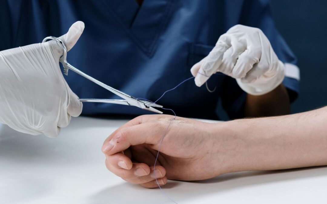 Why You Should Only Buy FDA-Approved Surgical Sutures